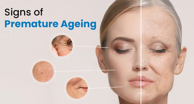 Signs of Premature Ageing