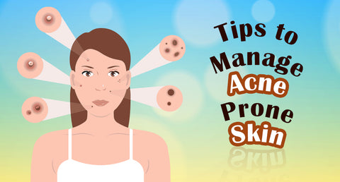 TIPS TO MANAGE ACNE PRONE SKIN