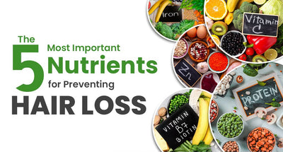 The 5 Most Important Nutrients for Preventing Hair Loss