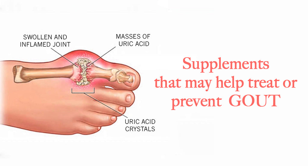 SUPPLEMENTS THAT MAY HELP TREAT OR PREVENT GOUT
