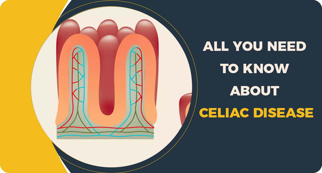 ALL YOU NEED TO KNOW ABOUT CELIAC DISEASE